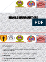 Hernias Diafragmaticas Congenitas y Adquiridas (Hiatales)
