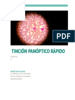 Informe TGL Tincion