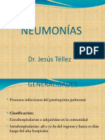 5- Neumonias y Bronquitis Aguda