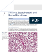 Chapter 7 - Steatosis Steatohepatitis and R - 2021 - Scheuer S Liver Biopsy Int