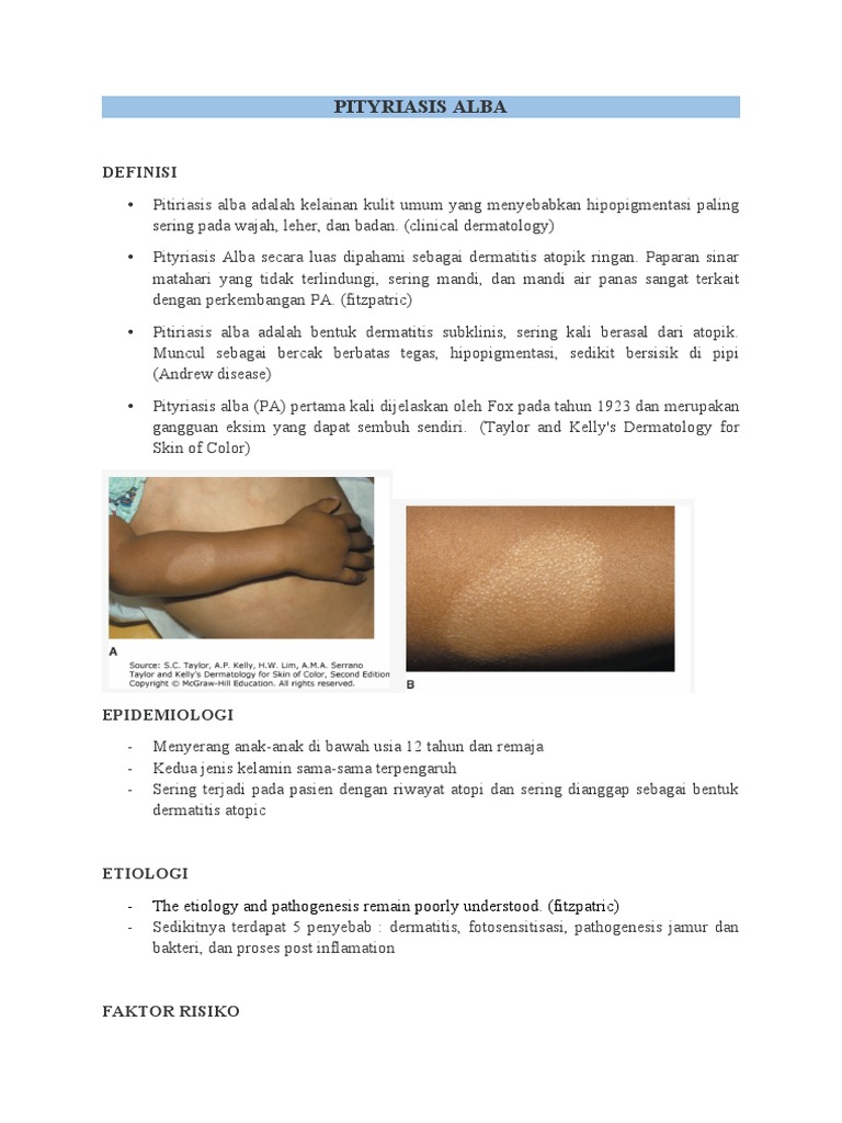Pityriasis Versicolor - Alba-Case 9 | PDF