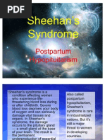 Sheehan's Syndrome