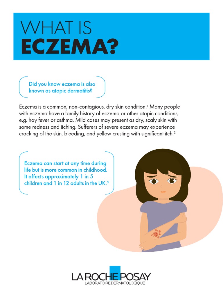 Discoid Eczema Patient Leaflet