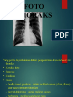 Baca Foto Thorax Iship RSPC