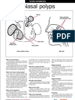 Nasal Polyps