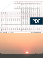 CURS ECG NR 4 Dec 2013