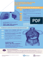 2 Infografia 2 Tipos de Tuberculosis