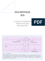 FMC 12.12.12 Topo ECG