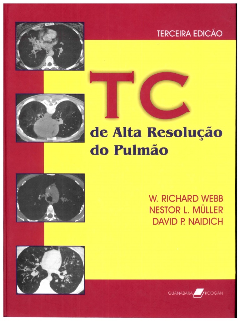 TC Alta Resolucao Pulmão Webb-Muller | PDF