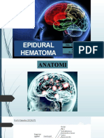 Epidural Hematoma: Oleh: Sofwatul Marfiyah Preseptor Dr. Andrian, Sp. B