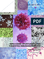 Infeccións Oportunistas en Pacientes Inmunodeprimidos
