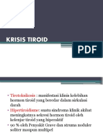 Krisis Tiroid
