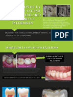 Exposición N°5 Preparación de La Cavidad de Acceso en Dientes Molares