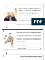 Nerve injury causes leg weakness