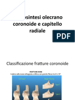 Osteosintesi Olecrano Capitello e Coronoide