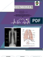 2.Pneumonia-Revina Destiana Samputri - 196100802025