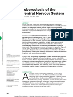 TUBERCULOSE DO SNC