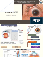 Catarata - Oftalmología Ex
