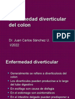 Enfermedad Diverticular Del Colon