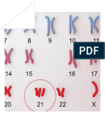 Síndrome de Down PDF