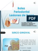 Bolsas Periodontales y Lesiones de Furca