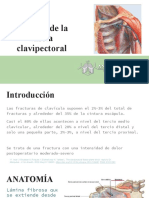 Bloqueo Ecoguiado de La Fascia Clavipectoral