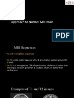 How To Approach To Normal MRI Brain