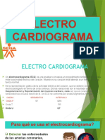 Electro Cardiograma (Ecg)