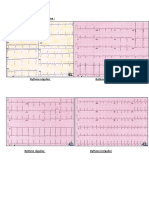 Exmpl ECG21-20