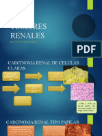 Carcinoma Renal