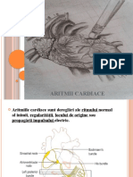 Aritmii Cardiace