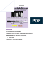 Radiografía abdominal: conceptos básicos y hallazgos comunes