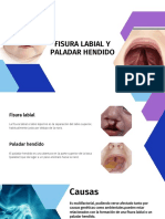 Paladar Hendido y Fisura Labial