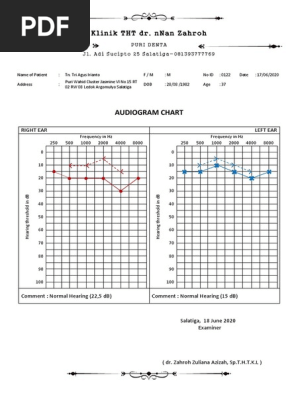 audiogram nnan