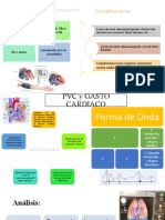 Consideraciones para colocación de catéter arterial femoral