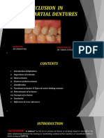 Occlusion in Fixed Partial Dentures