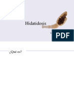 Hidatidosis