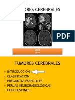 Neuro Oncología