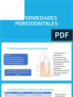  Enfermedades Periodontales