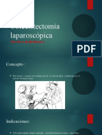 Colecistectomía Laparoscópica