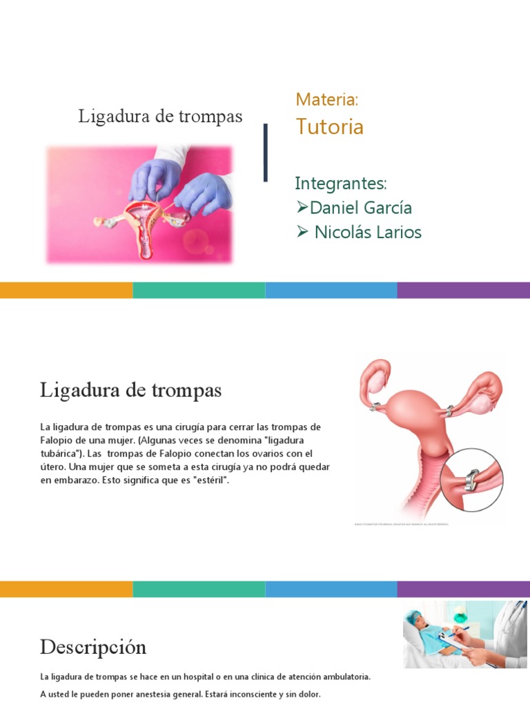 Ligadura de Trompas PDF Control de la natalidad El embarazo