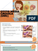 Otitis Media Cronica