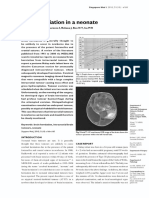 Brain Herniation in A Neonate