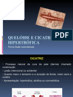 Cicatriz Hipertrofica e Queloide - 241-637907232222944384