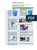 Elaborar Un Cuadro Comparativo en El Uso de Pañal y Colocación de Sonda Vesical para La Eliminación de La Orina