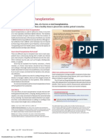 Transplante Fecal