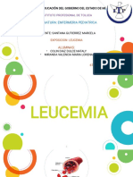 Leucemia 2