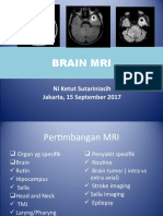 MRI BRAIN OPTIMAL