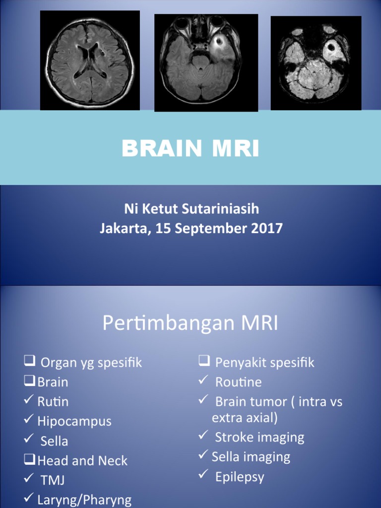 Mri Brain Pdf