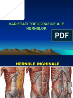 hernii 2